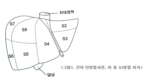 간의 단분절사진