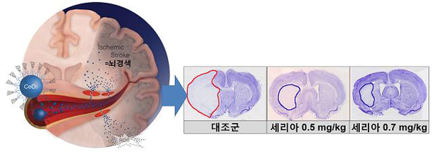 그림1 생체적합성을 높이기 위해 PEG를 코팅한 균질한 세리아 나노입자를 정맥으로 투여하였을 때 뇌경색의 크기가 약 50% 정도 줄어들었음