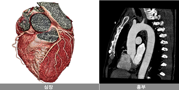 CT 검사로 구현 가능한 영상들