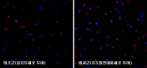 형광염색을 통한 현미경 검사 사진