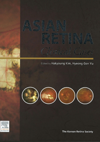 ASIAN RETINA : Clinical Cases