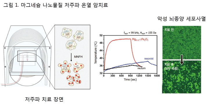 마그네슘 나노물질 발열로 인한 시험관 내 악성뇌종양 세포 사멸