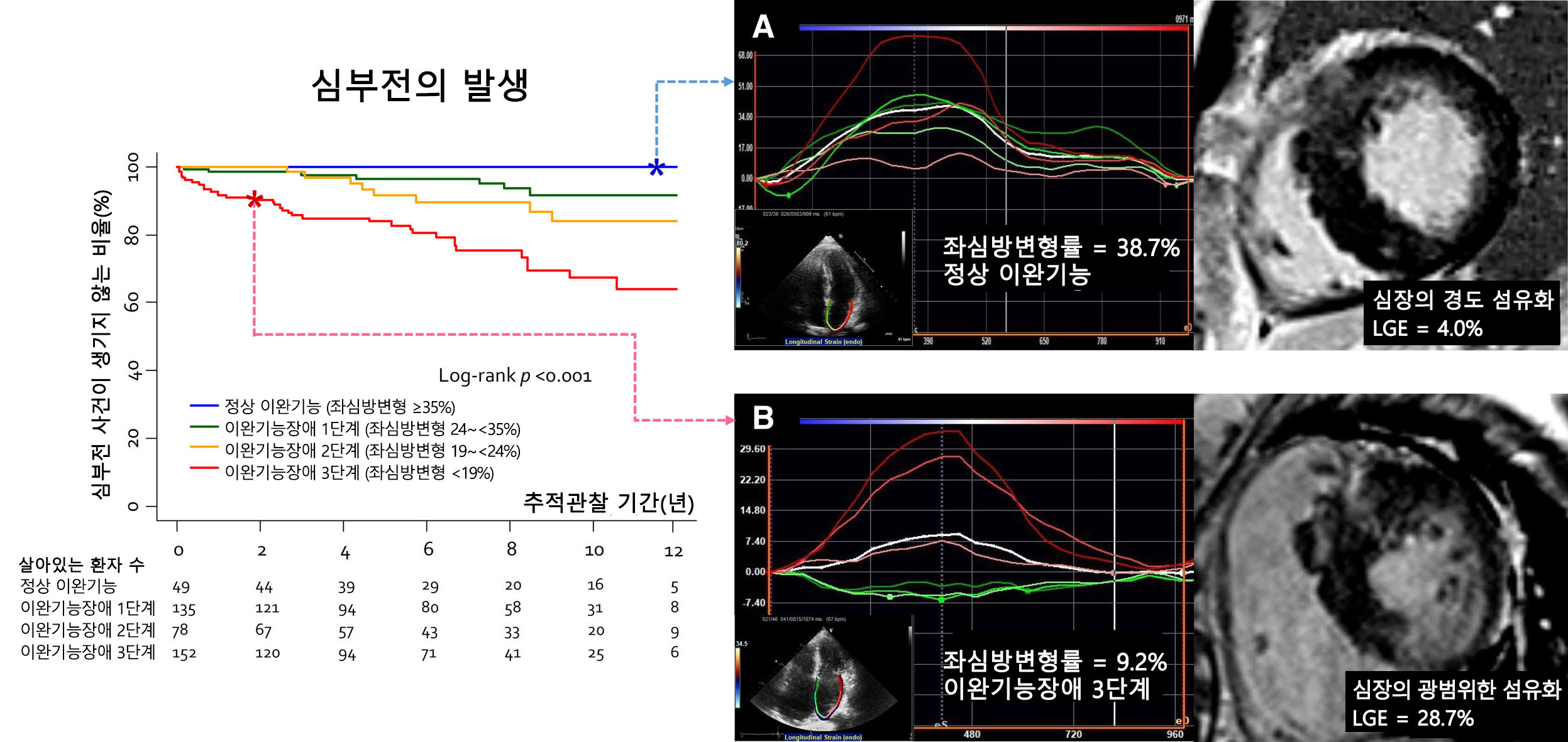 [그래프 왼쪽] 좌심방변형률에 따라 구분된 기능 장애 정도(정상 및 1~3단계) 및 비후성심근증환자의 심부전 관련 무사건 생존율 사이의 관계 [그래프 오른쪽] 비후성심근병 환자 중 (가) 경증 섬유증이 있는 정상 이완기능(좌심방변형률 38.7%)의 56세 남성, (나) 중증 섬유증이 있는 기능장애 3단계 그룹(좌심방변형률 9.2%)의 75세 여성.