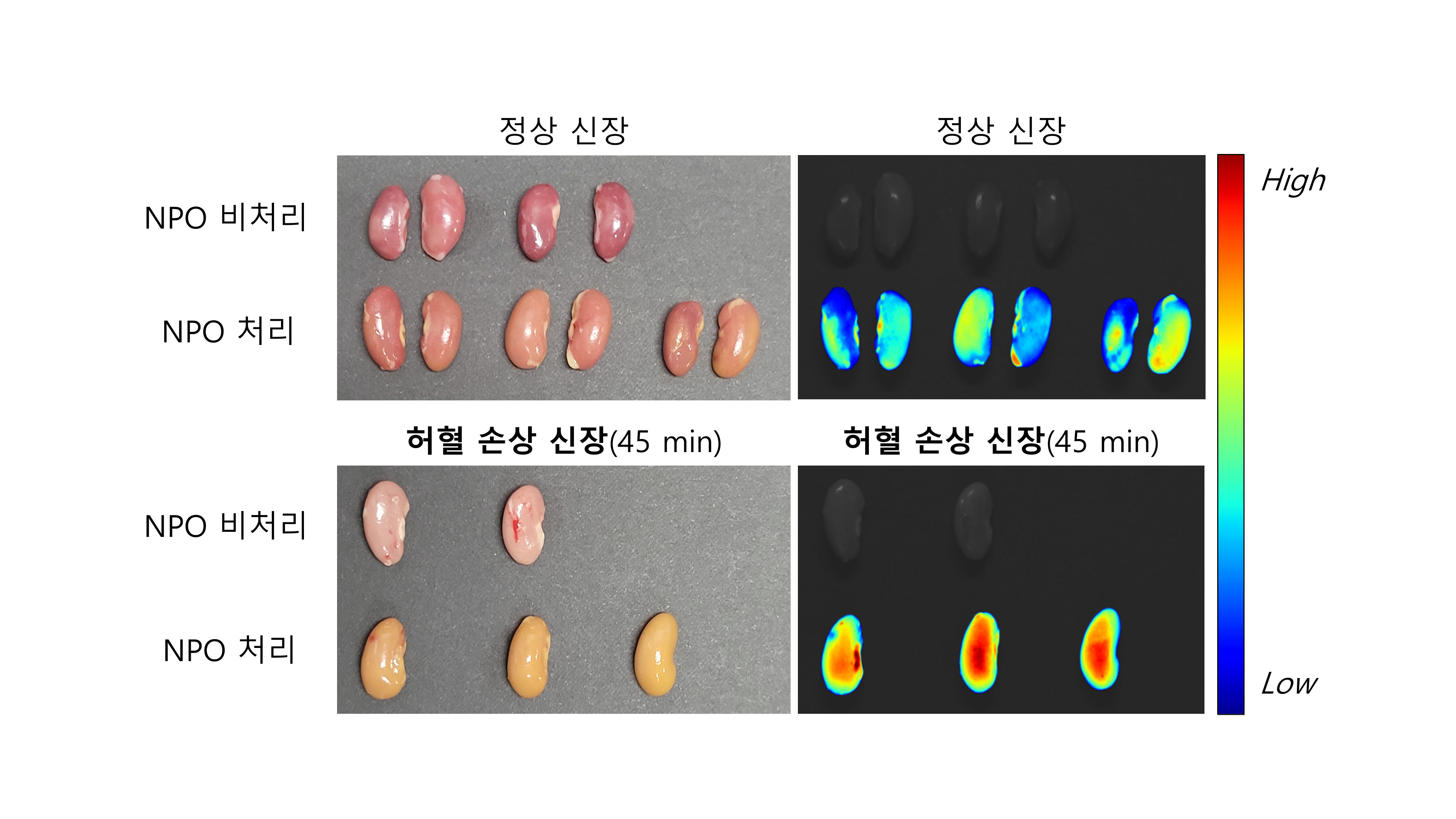 [이미지] 정상 쥐의 신장(위)과 허혈 손상 쥐의 신장(아래). 형광 분자 프로브(NPO) 처리 후 허혈 손상 신장에서 형광 강도가 높아진 것을 확인할 수 있음