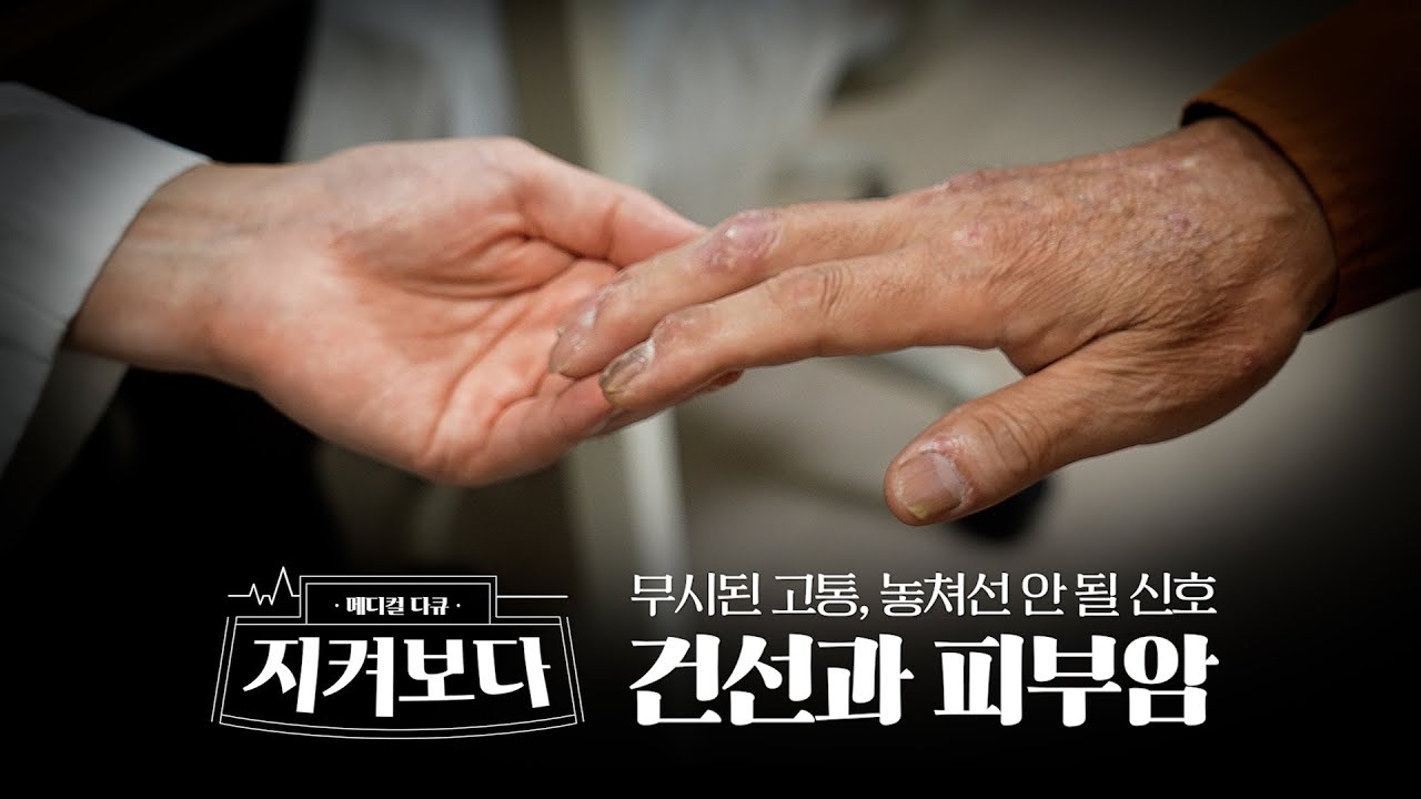 피부 위의 두 전쟁...건선과 피부암